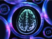 Ngủ trưa dài có thể là dấu hiệu ban đầu của bệnh Alzheimer